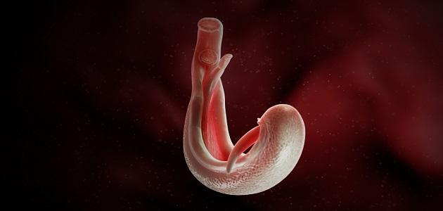 چرخه زندگی Schistosomiasis - موضوع
