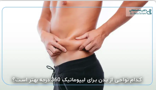 تفاوت لیپوماتیک ۳۶۰ درجه با لیپوماتیک شکم و پهلو در چیست؟